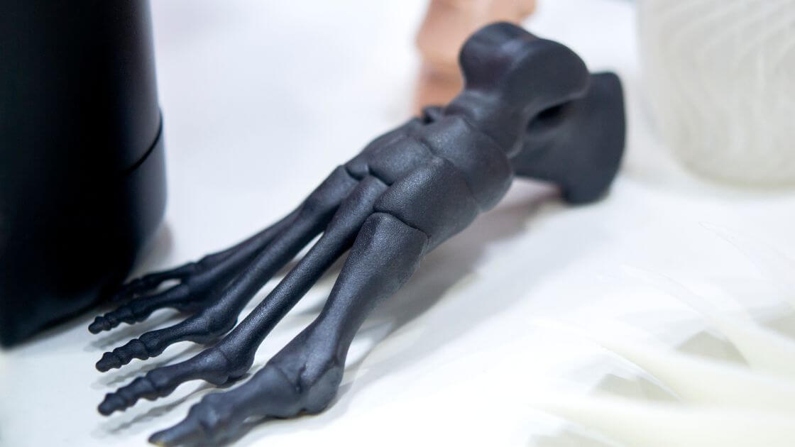 Implants